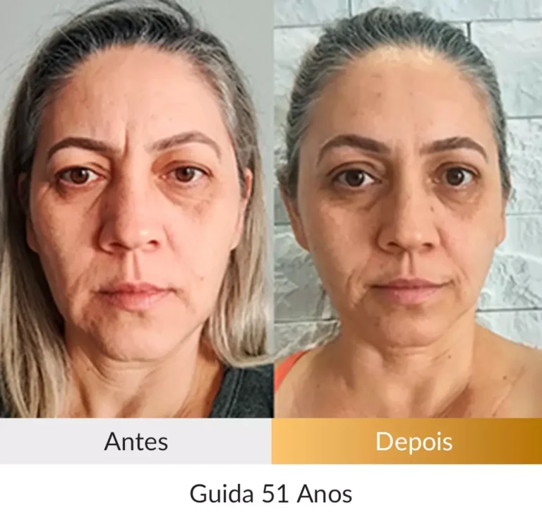 Depoimento-Metodo-Rosto-Firme-Foto-Guida-51-anos.webp