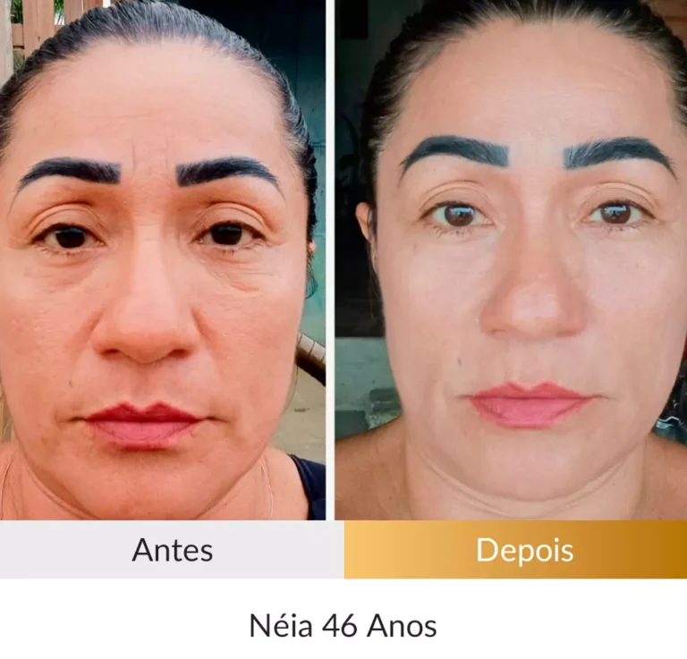 Depoimento-Metodo-Rosto-Firme-Foto-Neia-46-Anos.webp