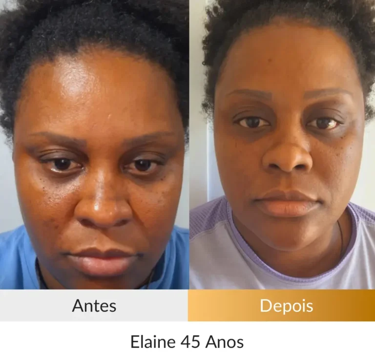 Elaine-45-anos.webp