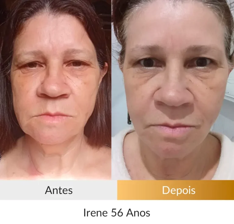 Irene-56-Anos.webp