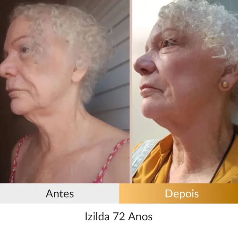 Izilda-72-anos.webp