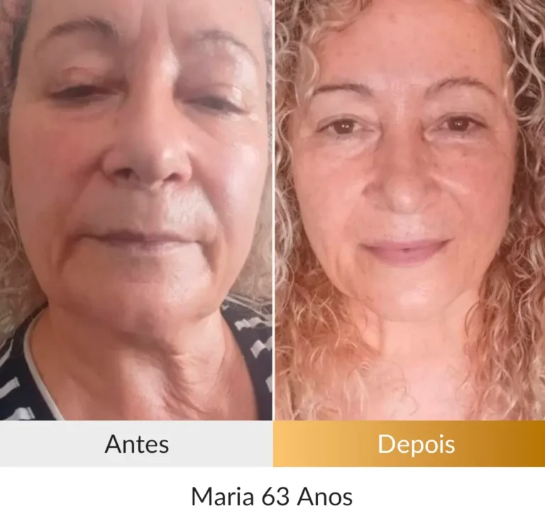 Maria-63-anos.webp