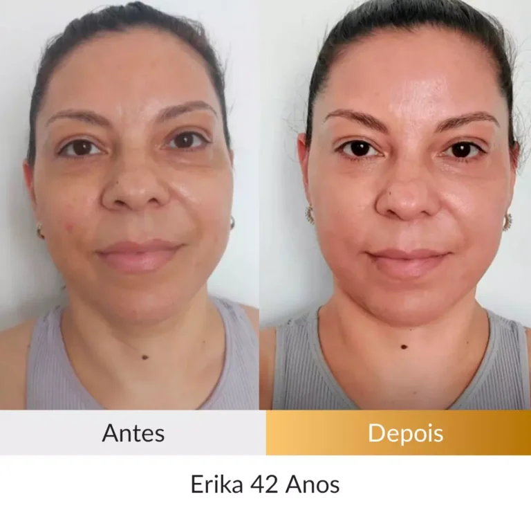 Transformacao-Erika-42-anos.webp