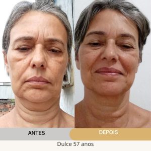 ANTES E DEPOIS (14)