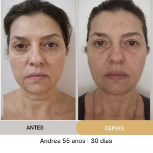 ANTES E DEPOIS (17)