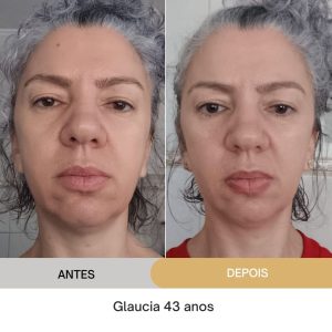 ANTES E DEPOIS (19)