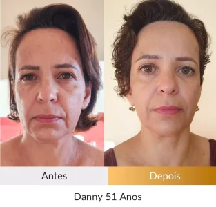 Depoimento-Metodo-Rosto-Firme-Foto-Danny-51-anos.webp