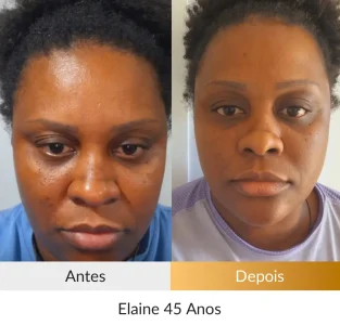 Elaine-45-anos.webp