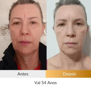 Val-54-anos.webp